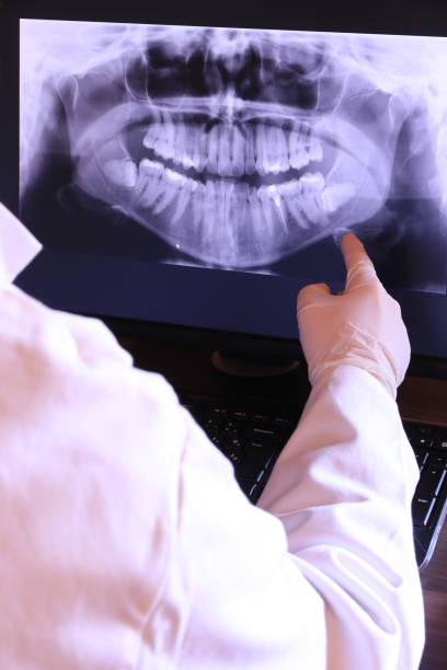 Best Knocked-Out Tooth (Avulsed Tooth) Treatment in Fallbrook, CA